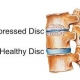 compressed disc
