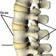 spinal disc