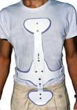 Cash Orthosis (Brace) Cash Orthosis (Brace)