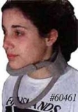 کولار گردنی سوختگی کولار گردنی سوختگی